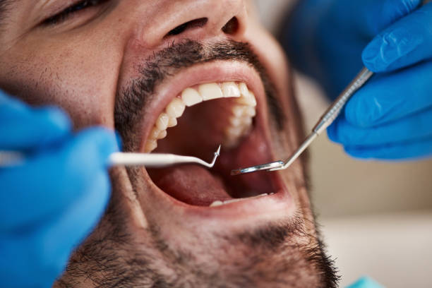 Emergency Dental Services in Palisades Park, NJ